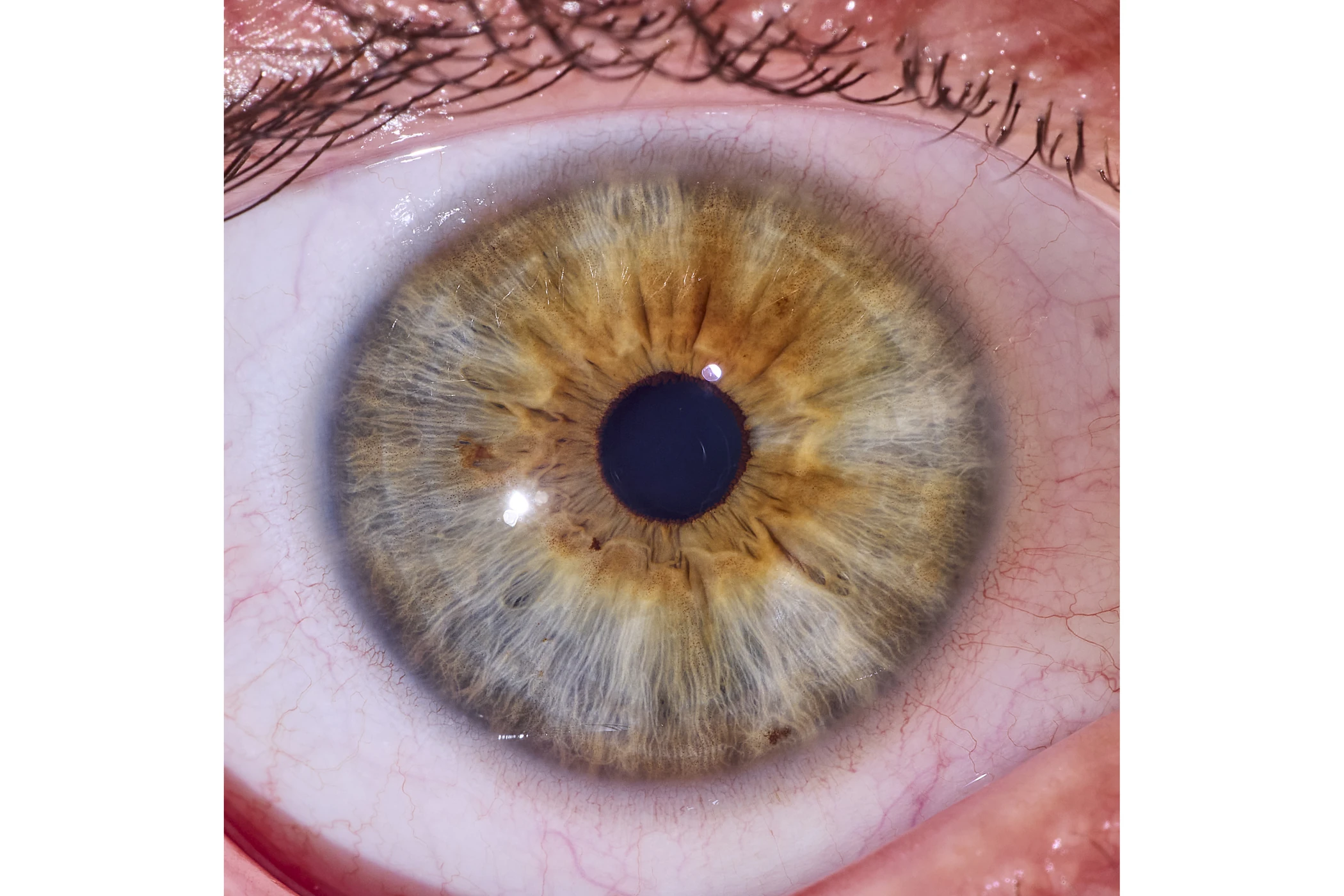 Unedited iris photograph straight from the studio camera